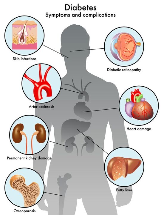 Insunol protects target organs from complications